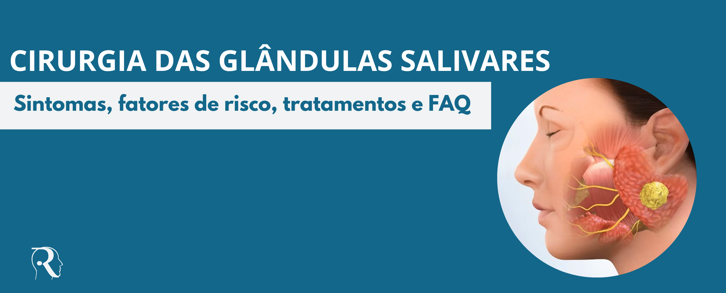 Glândulas Salivares, cirurgia, tratamentos, e dúvidas frequentes