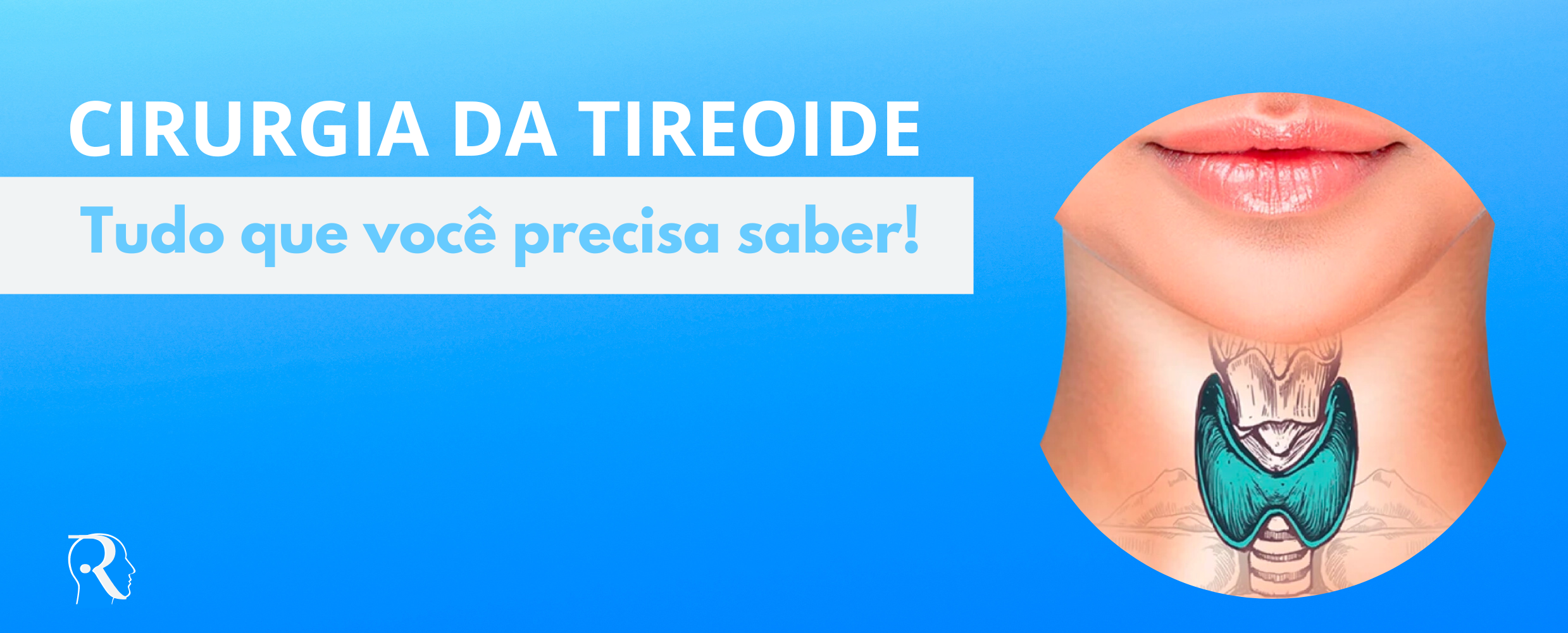 glândula tireoide e informações sobre a cirurgia